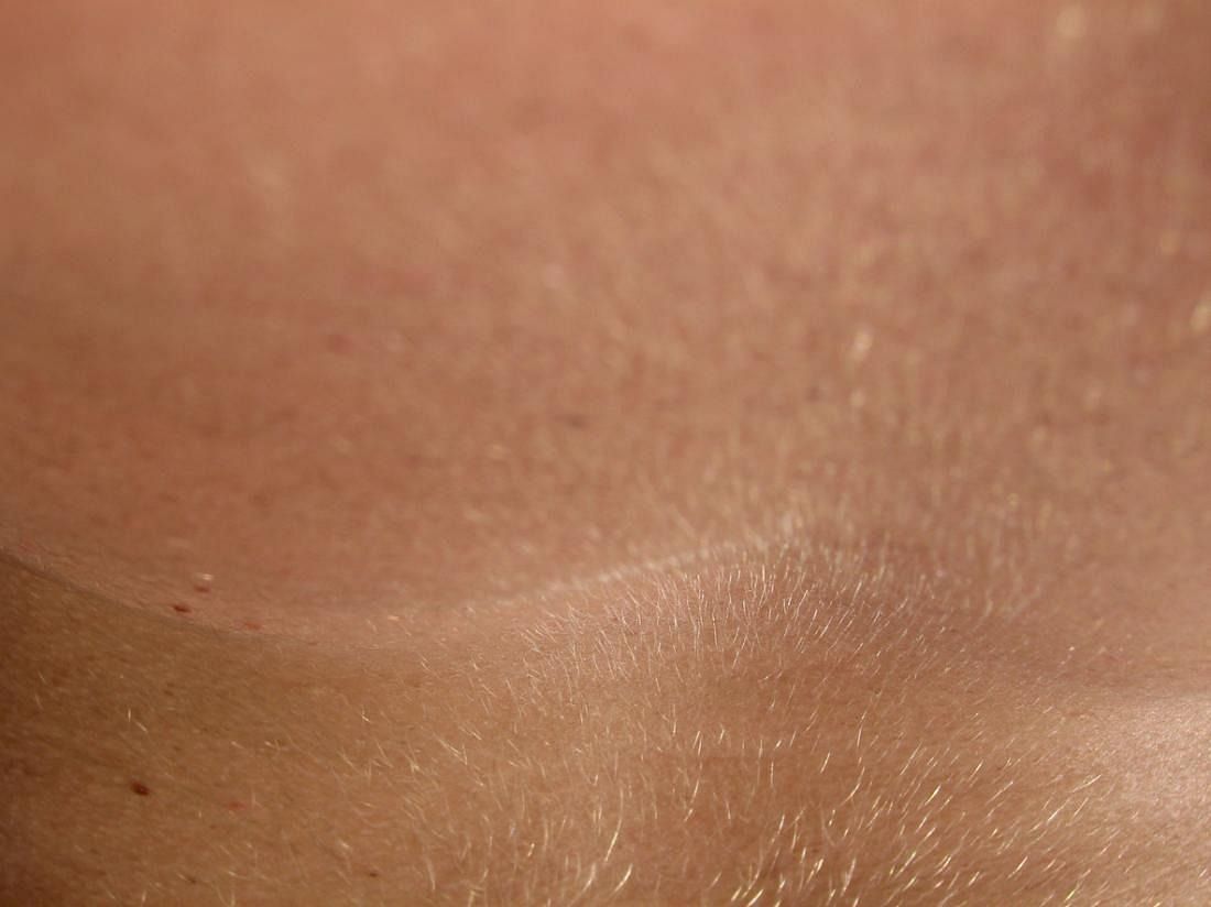 Body hair (Image via Cleveland Clinic)